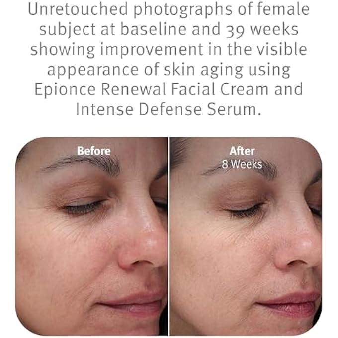 Epionce RENEWAL FACIAL CREAM - FOR DRY/SENSITIVE TO NORMAL SKIN 50G/1.7OZ - Image 4